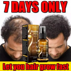 Unbranded Biotin Hair Growth Spray Anti Hair Loss Fast Regrowth Scalp Treatment Serum US