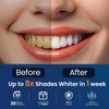 Teeth Whitening Strips: Enamel Safe Whitening Strip,White Strips for Teeth