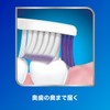 Shumitect Gentle Periodontal Care 3D Fit Toothbrush; *Color cannot be