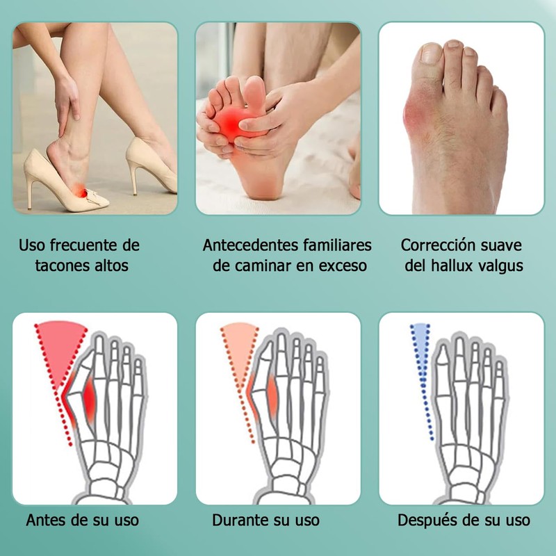 Corrector de Juanetes Para Hombre y Mujer Ajustable,Separador de Dedos