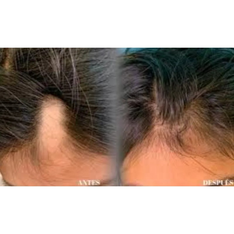 Shampoo De Cabello Romero - Anticaida - Rapunzel Zatarain