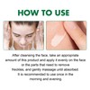 South Moon Eelhoe Dark Spot Correcting Glow Serum Whitening Freckle