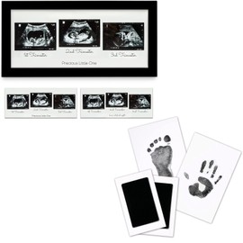 KeaBabies Baby Triple Sonogram Picture Frame Baby Footprint & Handprint Inkless Ink Pad Bundle - Baby Nursery Decor, Pregnant Mom Gifts (Onyx Black) - Newborn Baby Stamp Pad Kits (Jet Black)