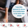 Povihome Gel Toe Separator, Pinky Toe Spacers, Little Toe Spacers