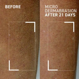 Exfoliante Corporal Hidratante De Microdermoabrasión Dr. Bra                                                                                          