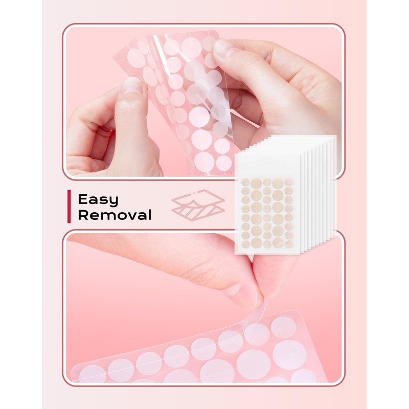 360 Pieces Invisible Pimple Patches, Hydrocolloid Spot Patches, Acne Treatment