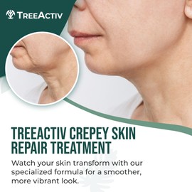 TreeActiv Crepey Skin Repair Cream, 8 oz, Firming Formula with Hyaluronic Acid & Shea Butter to Deeply Moisturize and Tighten Dry, Wrinkly Crepe Skin, 500+ Uses