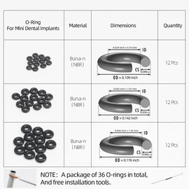 O-Ring, Buna-n, Tool Kit with 3 Convenient Sizes, Replacement for Mini Dental Implants