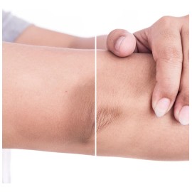 Stanhome Skin Glo Crema Exfoliante 300 Ml