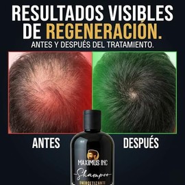 MAXIMUS INC Shampoo Artesanal con Biotina y Bergamota  Cuidado Capilar Energizante para Cabello Débil y Delgado  Limpieza Profunda que Fortalece...   