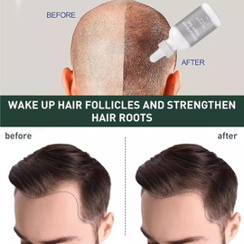 60ml,Deoxyribose Sugar Gel Hair Growth,Hair Growth Serum,Mild Hair Oil for Hair Strengthening,Hair Regrowth Treatment for Hair Strengthen and Nourish,Growing Hair Oil Scalp Gel for Men and Women
