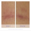 iS Clínica Super Serum Advance+, 29,57 ml