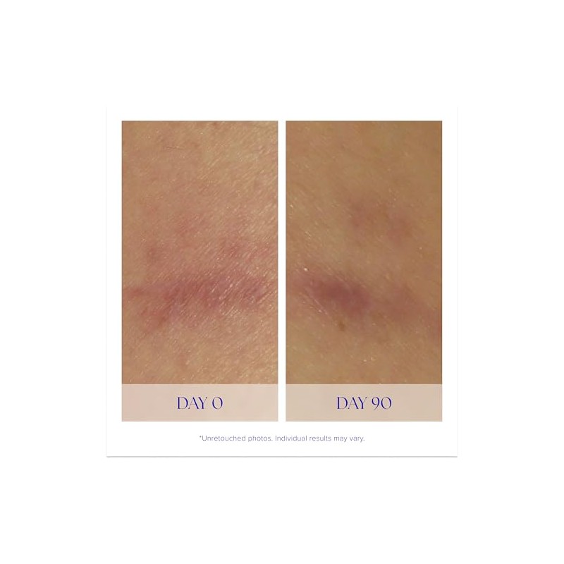 iS Clínica Super Serum Advance+, 29,57 ml