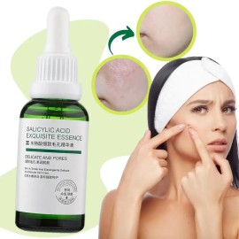 Liquido Antiacne Serum Reparador Espinillas Acido Salicilico