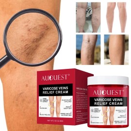 Varicose Veins Relief