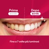 ESMILE Red Velvet Fruit Teeth Whitening Strips Professional Home Treatment