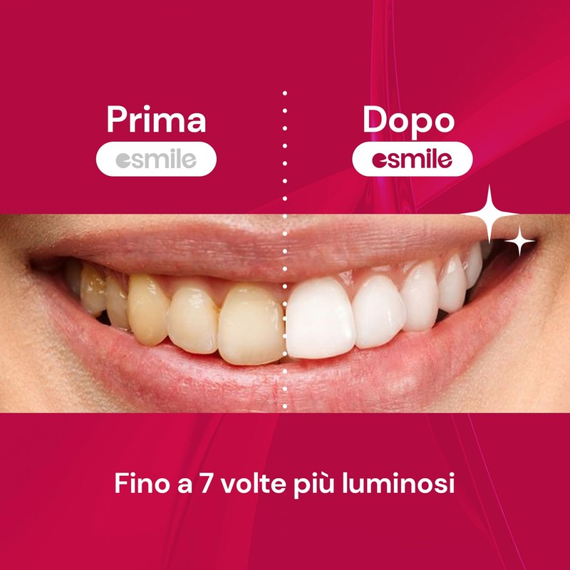 ESMILE Red Velvet Fruit Teeth Whitening Strips Professional Home Treatment