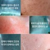 1+1 Blancclear Exosome Cica Mask Pack Soothing Moisture Skin Barrier