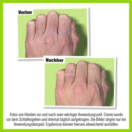 O'Keeffe's Working Hands 80 ml Tube 2 Pack - Hand Cream for Extremely Dry, Cracked Hands, Instantly Increases Moisture Content, Forms a Protective Layer and Prevents Moisture Loss