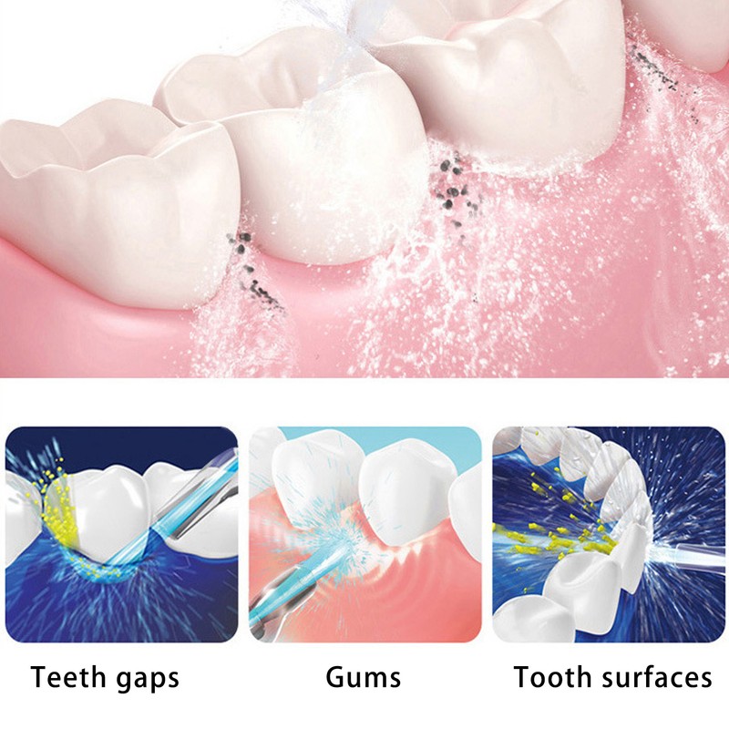 Electric Teeth Irrigator 360° Rotating Nozzle 3 Modes Plaque Remover