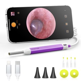 AnyScope AnyScope Digital Otoscope with Gyroscope, HD Ear Camera with Ear Wax Removal Tools, Video Ear Scope Otoscope with Light, Compatible with iPhone and Android (Purple)