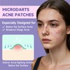 36-Count Microdart Acne Patches, Cute Round-shaped microdart pimple patch