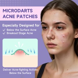 36-Count Microdart Acne Patches, Cute Round-shaped microdart pimple patch