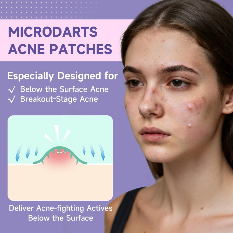 36-Count Microdart Acne Patches, Cute Round-shaped microdart pimple patch