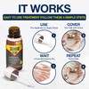 URIEL UPGRADED Ingrown Toenail Treatment, Ingrown Toenail Removal Kit, Ingrown