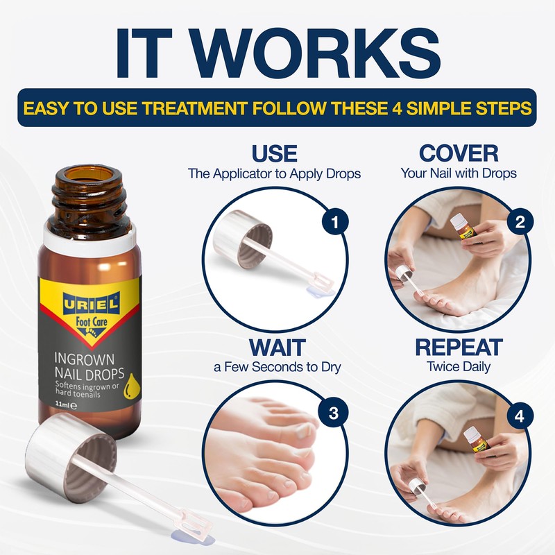 URIEL UPGRADED Ingrown Toenail Treatment, Ingrown Toenail Removal Kit, Ingrown