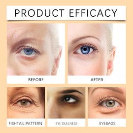 Crema para ojos en barra con retinol y cúrcuma, bálsamo iluminador para debajo de los ojos, bálsamo hidratante en barra para ojeras, crema antienvejecimiento, reduce la hinchazón (1)