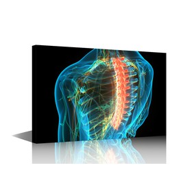 Office Wall Art Human Spine X-Ray Large Canvas Wall Art Back Muscles Bones Contemporary Modern Artwork 3D Spine Pictures Wall Art for Nurse Physicians Assistant Framed Ready to Hang - 12" Wx18 H