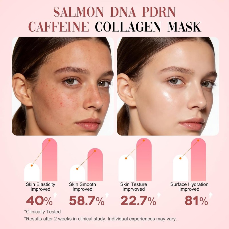 ISTON Collagen Face Mask with PDRN Salmon DNA Caffeine|Perm Diffusing
