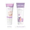 MOM to MOM Crema Intensiva para Estrías en el Embarazo