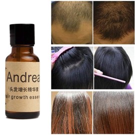Aceite Capilar Hidratante Tratamiento Anti Caida Potencia el Crecimiento del Cabello Largo Extra Volumen Andrea Solucion Crecimiento Regenera Detiene Caida Cabello (1 Pieza)