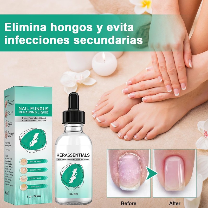 2 Piezas Krassentiales Líquido Reparador de Uñas de Los Pies,