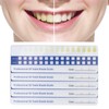5pcs Teeth Whitening Shade Guide, Tooth Shade Chart Comparing Card,