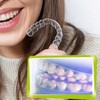 Custom Clear Retainer, Dental Retainer for Adults & Teens, Slim,