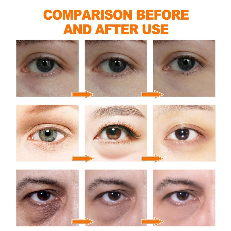 FunnAura Dark Circle Eye Cream Set, Eye Bags Remover with