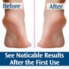 Pedifix Deep Healing Foot Cream 4oz Pack of 1 /