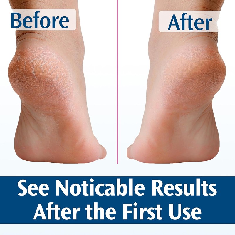 Pedifix Deep Healing Foot Cream 4oz Pack of 1 /