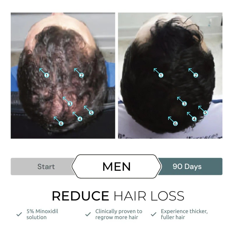 Sérum Capilar Ds Laboratories Spectral.f7 Hair Recgrowth