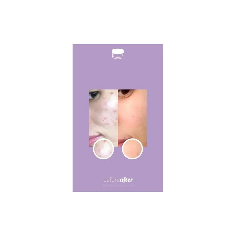 Juveness Crema Facial Hipoalergénica Sublime Cover Sens Piel Sensible 50mL