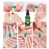 7 days Nail Treatment, Ginger Nail Treatment, Nail Nutrient Oil