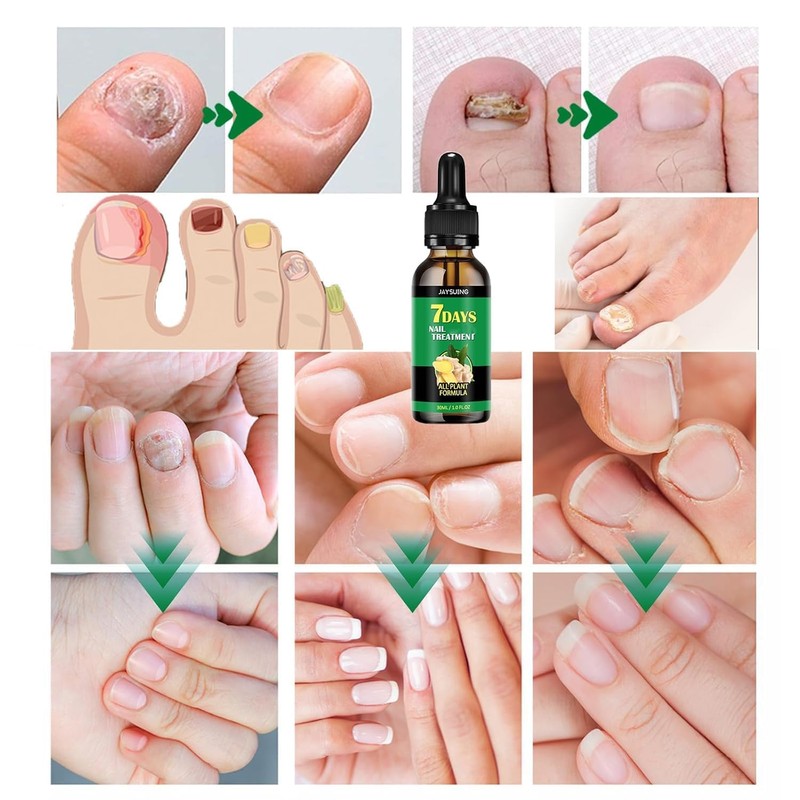 7 days Nail Treatment, Ginger Nail Treatment, Nail Nutrient Oil