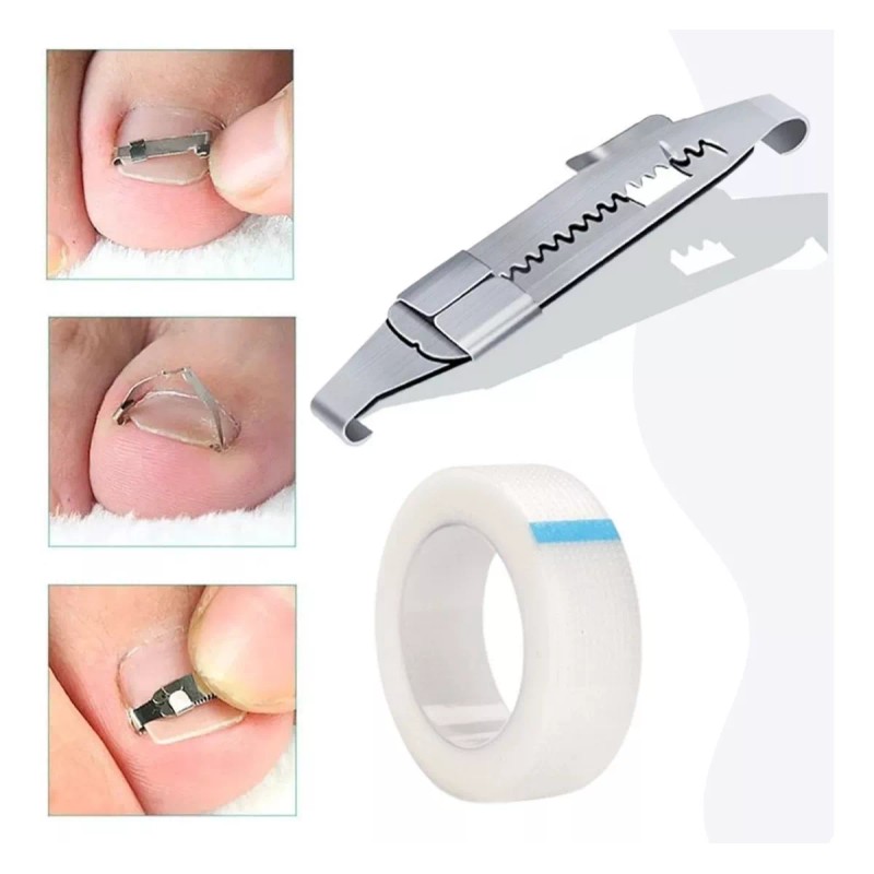 Universo en Linea Herramientas Corrección De Uñas Encarnadas Alivia Dolor