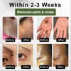 Luhaka Luhaka DermaEase Natureerase Instant Mole Spot Removal Gel,Purifying gel