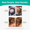 Shapiro MD Conditioner Containing the 3 Most Powerful, All-Natural DHT