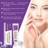 Creme De Ácido Azelaico Essência Facial 12% 20g Anti-acne