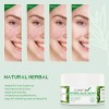 Crema Herbal Antiacné Control Grasa, Granos Espinillas 2 Pzs Acneica